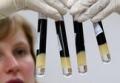 Смертность в мире от СПИДа сокращается